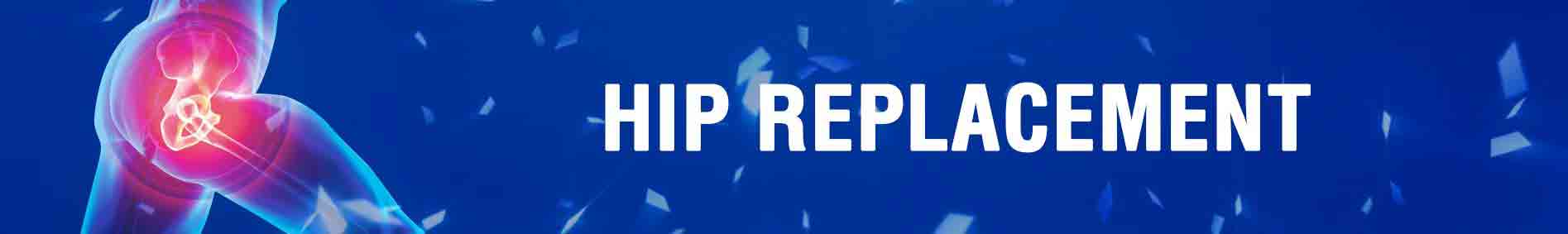 HIP REPLACEMENT